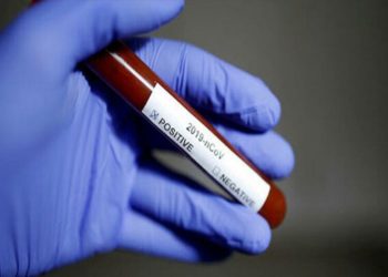 Abhazya’da dört yeni koronavirüs vakası tespit edildi.